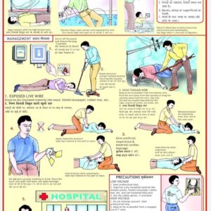 Electric Shock Treatment Chart